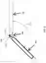 Fig. 25 - Tissue alignment for surgical closure