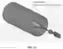 Fig. 11 - METHOD AND APPARATUS FOR TREATING A PATIENT BY INTENTIONALLY OCCLUDING A BLOOD VESSEL, INCLUDING METHOD AND APPARATUS FOR INDUCING WEIGHT LOSS IN A PATIENT BY INTENTIONALLY OCCLUDING THE CELIAC ARTERY