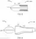 Fig. 05 - Low radial force vascular device and method of occlusion