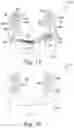 Fig. 13 - Method of designing and manufacturing low-profile customized patient-specific orthopaedic surgical instruments