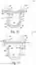Fig. 22 - Method of designing and manufacturing low-profile customized patient-specific orthopaedic surgical instruments