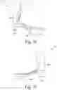 Fig. 24 - Method of designing and manufacturing low-profile customized patient-specific orthopaedic surgical instruments