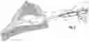 Fig. 06 - Surgical device with light