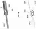Fig. 08 - INLINE CUTTER FOR CUTTING AND RETRIEVING IMPLANTED MICROSURGICAL DEVICES