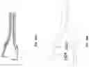Fig. 13 - INLINE CUTTER FOR CUTTING AND RETRIEVING IMPLANTED MICROSURGICAL DEVICES