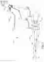 Fig. 06 - Systems and methods for deploying an implantable medical electrical lead