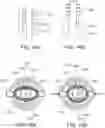 Fig. 08 - Replaceable inner tube