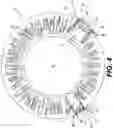 Fig. 05 - Protector for a Trans-Corneal Incision