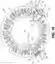 Fig. 17 - Protector for a Trans-Corneal Incision