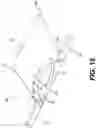 Fig. 19 - Protector for a Trans-Corneal Incision