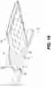 Fig. 20 - Protector for a Trans-Corneal Incision