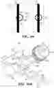 Fig. 13 - System and method for bone fixation using a nail locked to an encircling anchor