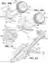 Fig. 14 - System and method for bone fixation using a nail locked to an encircling anchor