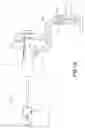 Fig. 15 - Directional kyphoplasty device and method of using such a device