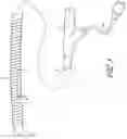 Fig. 04 - Systems for treating a hollow anatomical structure