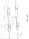 Fig. 13 - Systems for treating a hollow anatomical structure