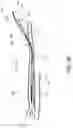 Fig. 21 - Systems for treating a hollow anatomical structure