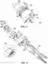 Fig. 04 - Actuator apparatus for operating a surgical instrument