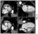 Fig. 09 - System and Method for Image-Guided Treatment Planning