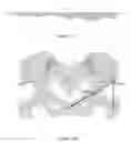 Fig. 13 - Systems and methods for determining a joint center of rotation during a procedure
