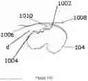 Fig. 14 - Systems and methods for determining a joint center of rotation during a procedure