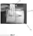 Fig. 07 - ORTHOPEDIC IMPLANT CARRIER SYSTEM AND METHOD