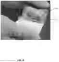 Fig. 09 - ORTHOPEDIC IMPLANT CARRIER SYSTEM AND METHOD