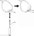 Fig. 01 - Tooth repair system