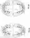 Fig. 05 - Dental appliances and associated methods of manufacturing
