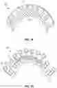 Fig. 15 - Dental appliances and associated methods of manufacturing