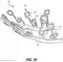 Fig. 16 - Dental appliances and associated methods of manufacturing