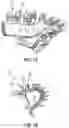 Fig. 17 - Dental appliances and associated methods of manufacturing