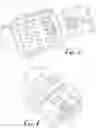 Fig. 03 - Orthodontic bracket with a biased ligating member
