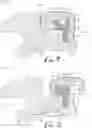 Fig. 05 - Orthodontic bracket with a biased ligating member