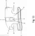 Fig. 15 - Self-ligating bracket with cantilever locking beam mechanism and other locking elements for ligating sliding members, and methods of making and use thereof