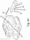 Fig. 45 - Self-ligating bracket with cantilever locking beam mechanism and other locking elements for ligating sliding members, and methods of making and use thereof