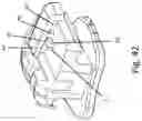 Fig. 46 - Self-ligating bracket with cantilever locking beam mechanism and other locking elements for ligating sliding members, and methods of making and use thereof