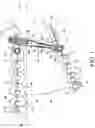 Fig. 02 - Method and apparatus for treating malocclusions and teeth alignment