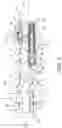 Fig. 03 - Method and apparatus for treating malocclusions and teeth alignment