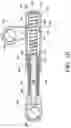 Fig. 11 - Method and apparatus for treating malocclusions and teeth alignment