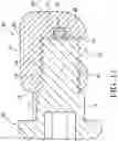 Fig. 12 - Method and apparatus for treating malocclusions and teeth alignment