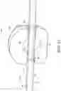 Fig. 14 - Method and apparatus for treating malocclusions and teeth alignment