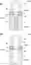 Fig. 01 - Biological tissue rootage face, implant, method for forming biological tissue rootage face, and method for producing implant