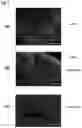 Fig. 07 - Biological tissue rootage face, implant, method for forming biological tissue rootage face, and method for producing implant