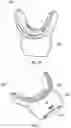 Fig. 14 - Mouthpiece for teeth whitening