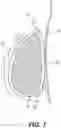 Fig. 06 - Breast treatment device