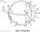 Fig. 02 - Ocular protection ring