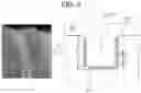 Fig. 06 - Intraocular lens and method of manufacturing the same