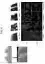 Fig. 07 - Intraocular lens and method of manufacturing the same