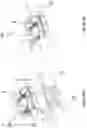 Fig. 10 - Lens case and lens delivery system